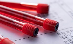 LED行业市场份额有望进一步向头部品牌集中LED行业发展前景预测2024(图7)